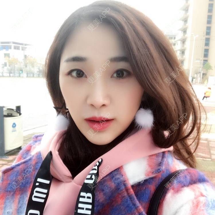 更美 - honey堤的光子嫩肤经验 | 北京 | 光子嫩肤
