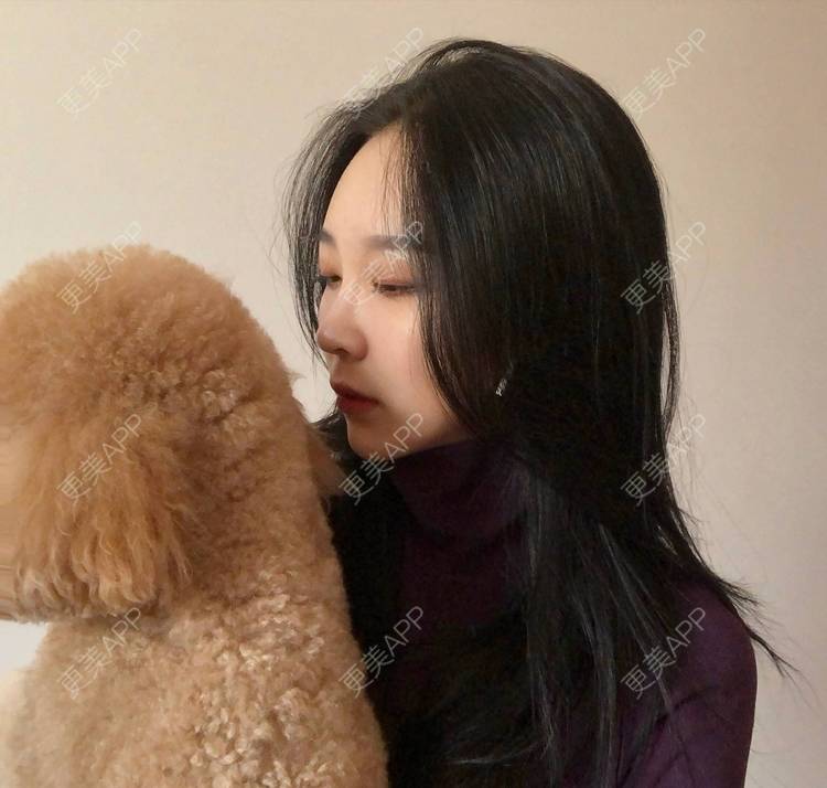 更美 - 迷乱花海拐的微针水光经验 | 德州 | 微针水光