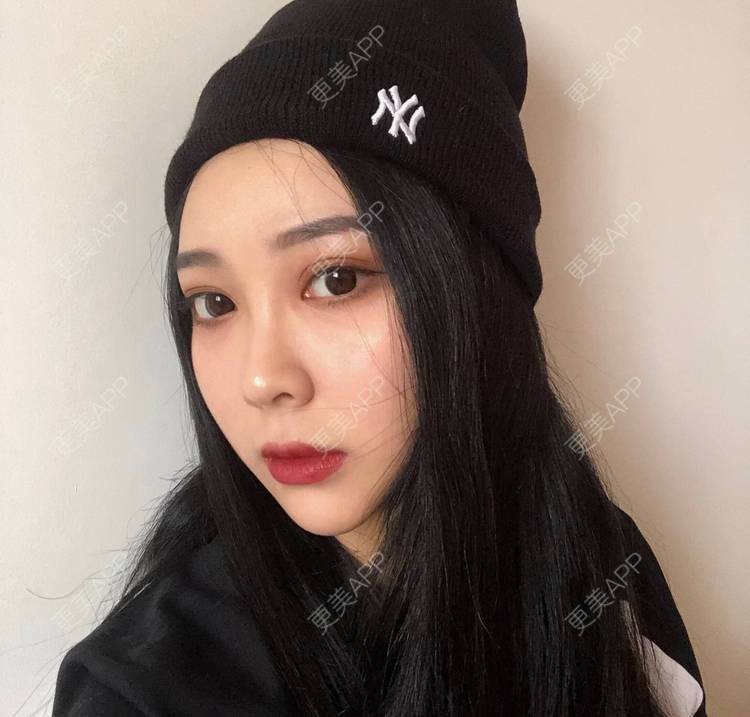 更美 - 迷乱花海拐的微针水光经验 | 德州 | 微针水光