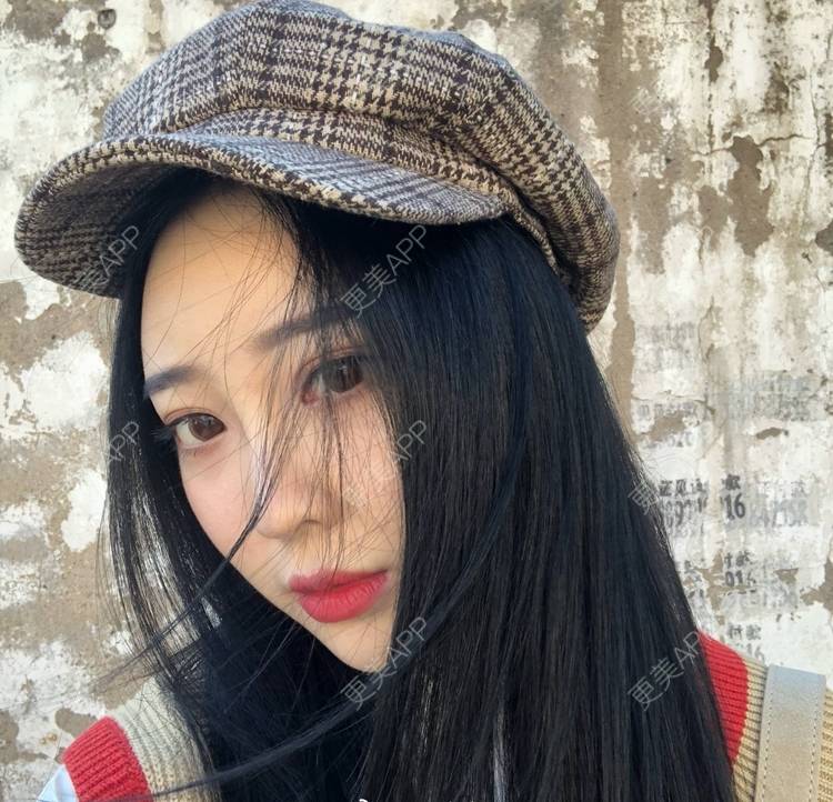 更美 - 迷乱花海拐的微针水光经验 | 德州 | 微针水光
