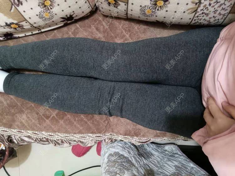 更美 - 更美用户wpDPDzkg9j的腰腹吸脂经验 | 吸脂瘦大腿 | 超声溶脂瘦大腿 | 射频溶脂瘦大腿 | 冷冻减脂瘦大腿 | 光纤溶脂瘦大腿 | 背部吸脂 | 小腿吸脂 | 手臂吸脂 | 吸脂塑臀 | 腰部吸脂 | 腹部吸脂 | 吸脂