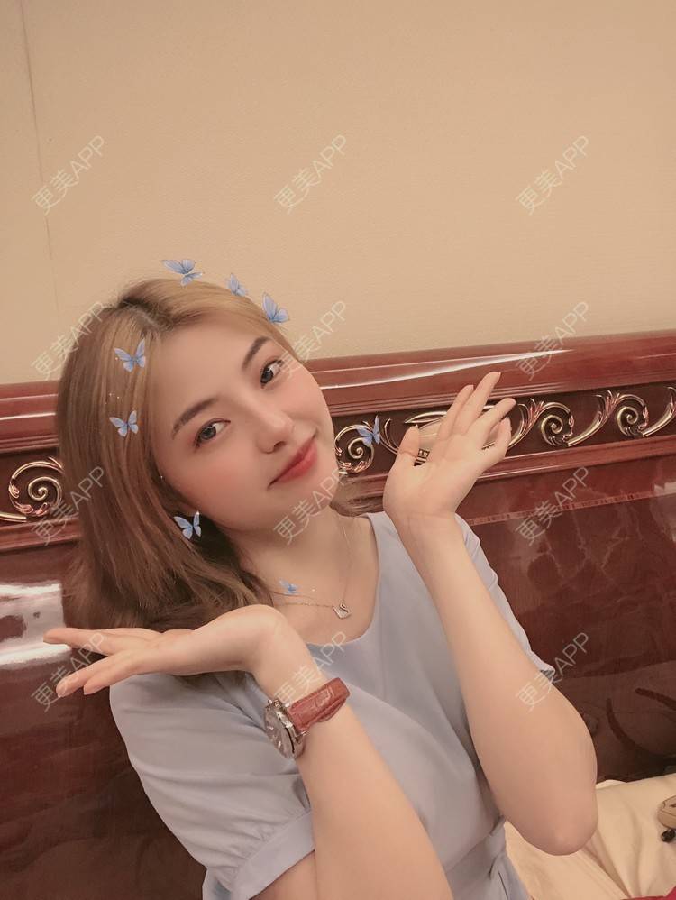 更美 - 原来就是你们的耳软骨隆鼻经验 | 耳软骨隆鼻 | 广州 | 视频日记