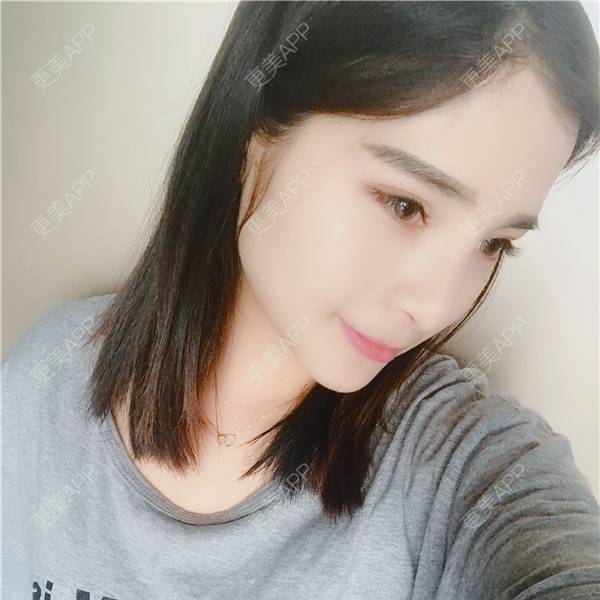更美 - 更美用户AWHhEUXo17的硅胶垫下巴经验 | 视频日记 | 硅胶垫下巴 | 重庆