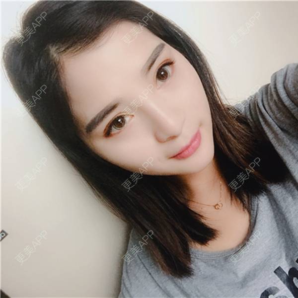 更美 - 更美用户AWHhEUXo17的硅胶垫下巴经验 | 视频日记 | 硅胶垫下巴 | 重庆
