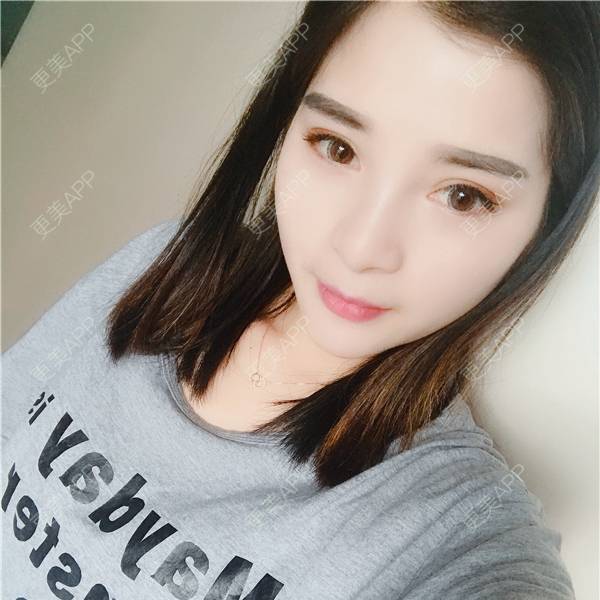 更美 - 更美用户AWHhEUXo17的硅胶垫下巴经验 | 视频日记 | 硅胶垫下巴 | 重庆