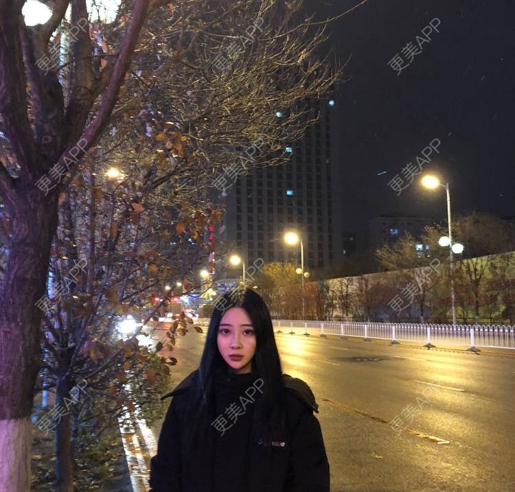 更美 - 迷乱花海拐的微针水光经验 | 德州 | 微针水光