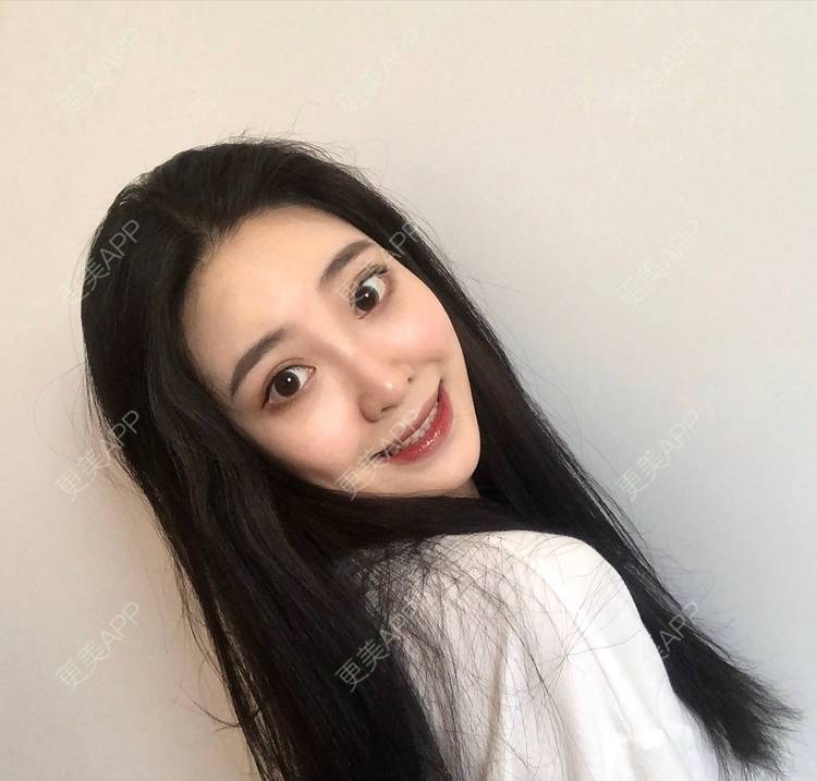 更美 - 迷乱花海拐的微针水光经验 | 德州 | 微针水光