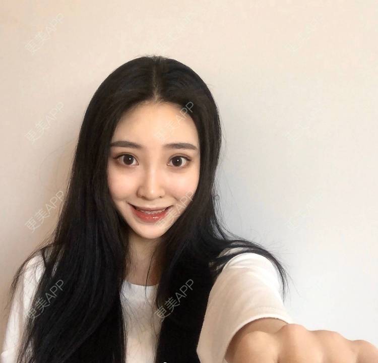更美 - 迷乱花海拐的微针水光经验 | 德州 | 微针水光