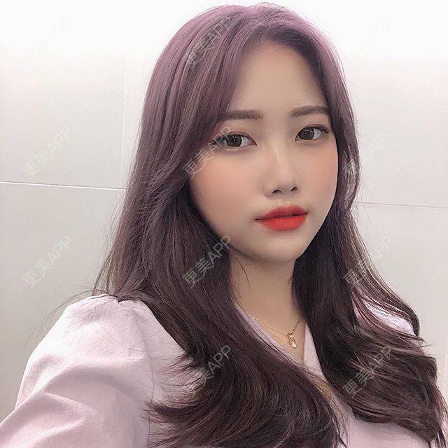 更美 - 更美用户twnJc6Xgus的鼻翼缩小经验 | 鼻翼缩小