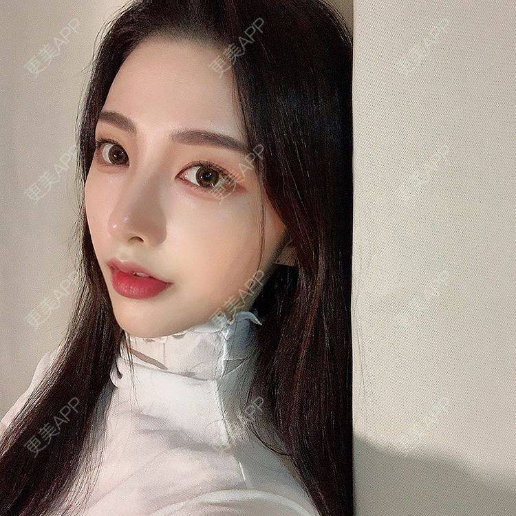 更美 - 更美用户twnJc6Xgus的嗨体淡化颈纹经验 | 嗨体淡化颈纹