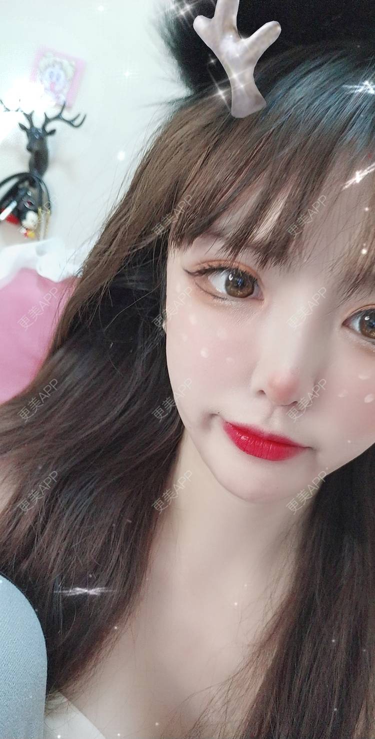 更美 - 晴天baby的假体隆胸经验 | 假体隆胸 | 郑州