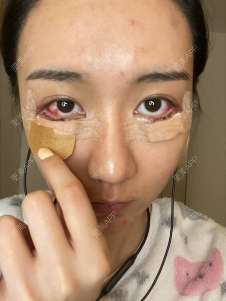 更美 - 戴嘉莉的眼部多项经验 | 深圳 | 眼部多项