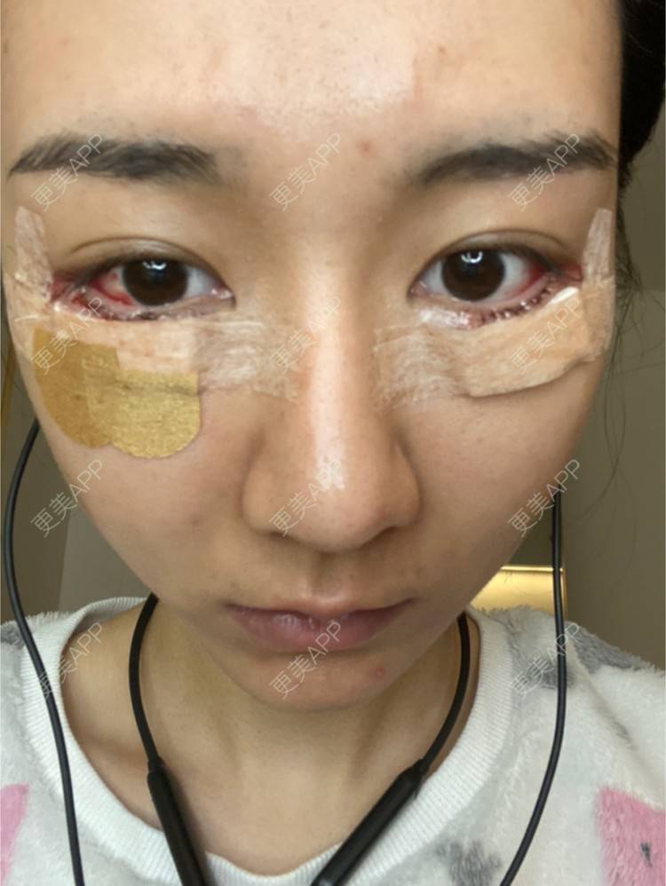 更美 - 戴嘉莉的眼部多项经验 | 深圳 | 眼部多项
