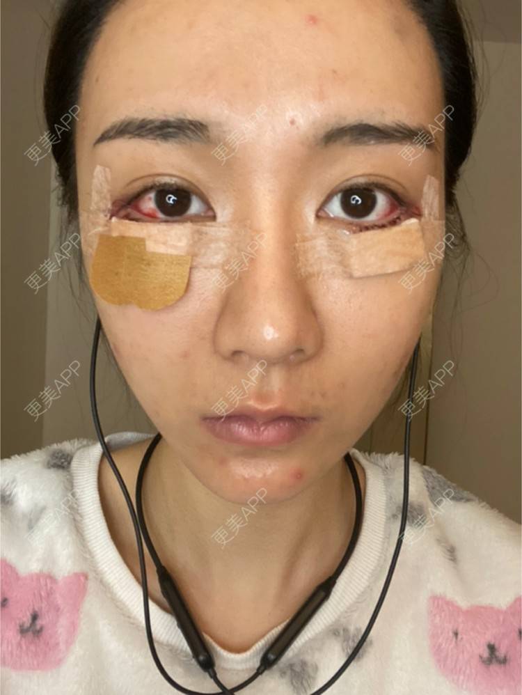 更美 - 戴嘉莉的眼部多项经验 | 深圳 | 眼部多项
