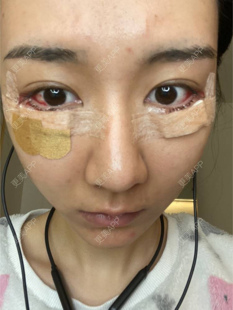 更美 - 戴嘉莉的眼部多项经验 | 深圳 | 眼部多项