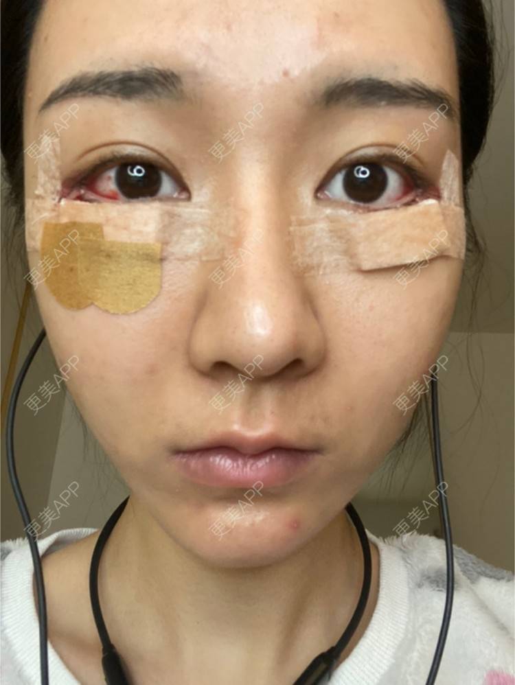 更美 - 戴嘉莉的眼部多项经验 | 深圳 | 眼部多项