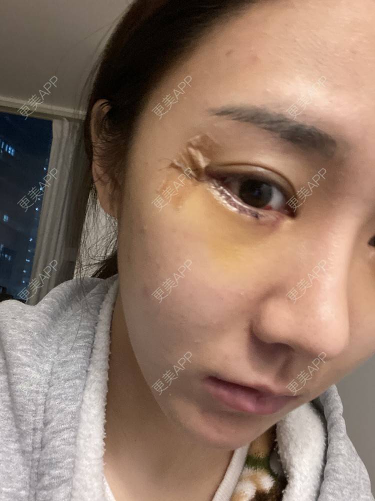 更美 - 戴嘉莉的眼部多项经验 | 深圳 | 眼部多项
