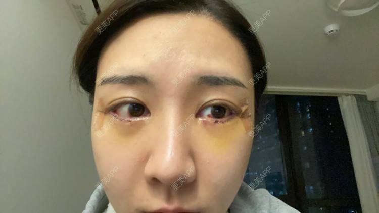 更美 - 戴嘉莉的眼部多项经验 | 深圳 | 眼部多项