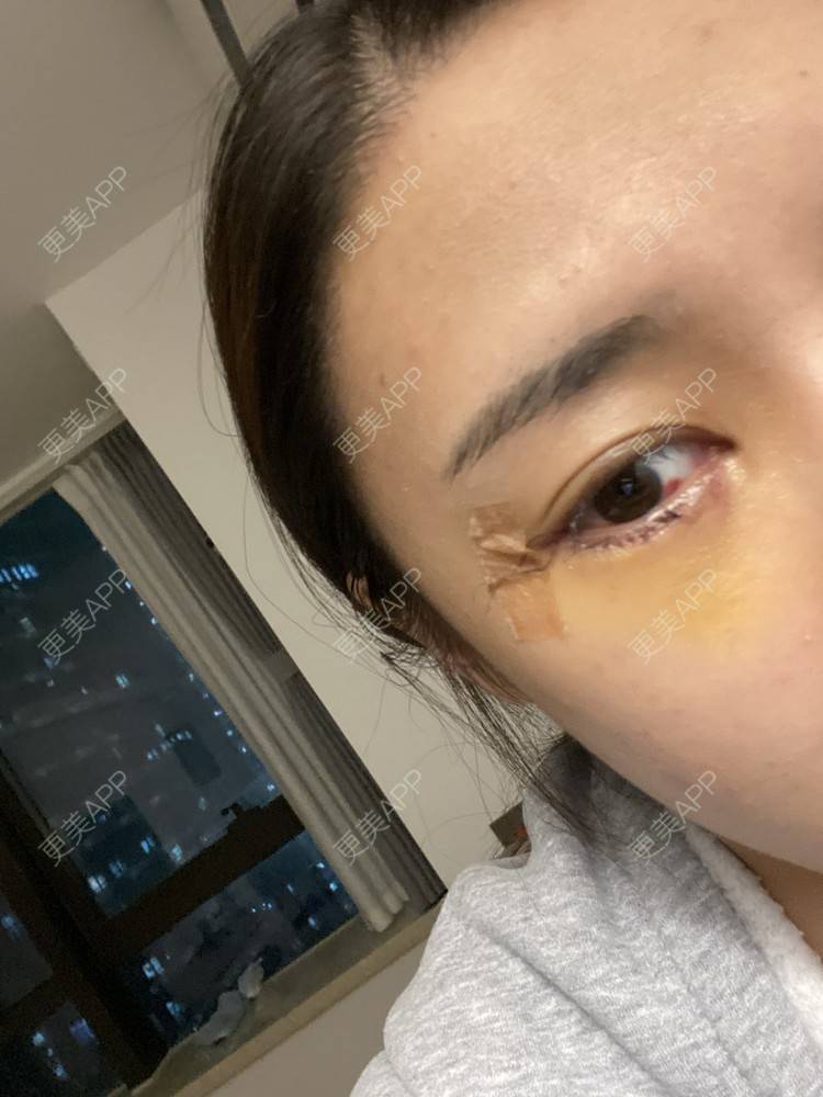 更美 - 戴嘉莉的眼部多项经验 | 深圳 | 眼部多项