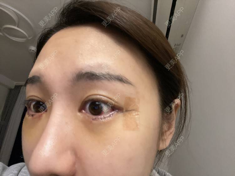 更美 - 戴嘉莉的眼部多项经验 | 深圳 | 眼部多项
