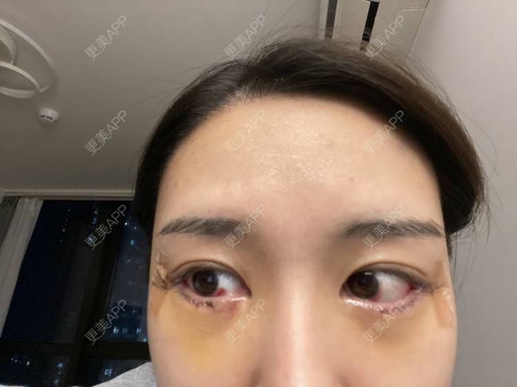 更美 - 戴嘉莉的眼部多项经验 | 深圳 | 眼部多项