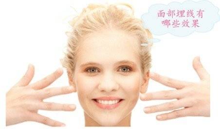 更美 - 更美用户YmNJkOPTXw的埋线除皱经验 | 埋线除皱 | 白银