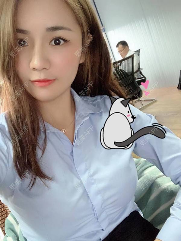 更美 - 更美用户3dxq4evfQ4的手臂吸脂经验 | 手臂吸脂