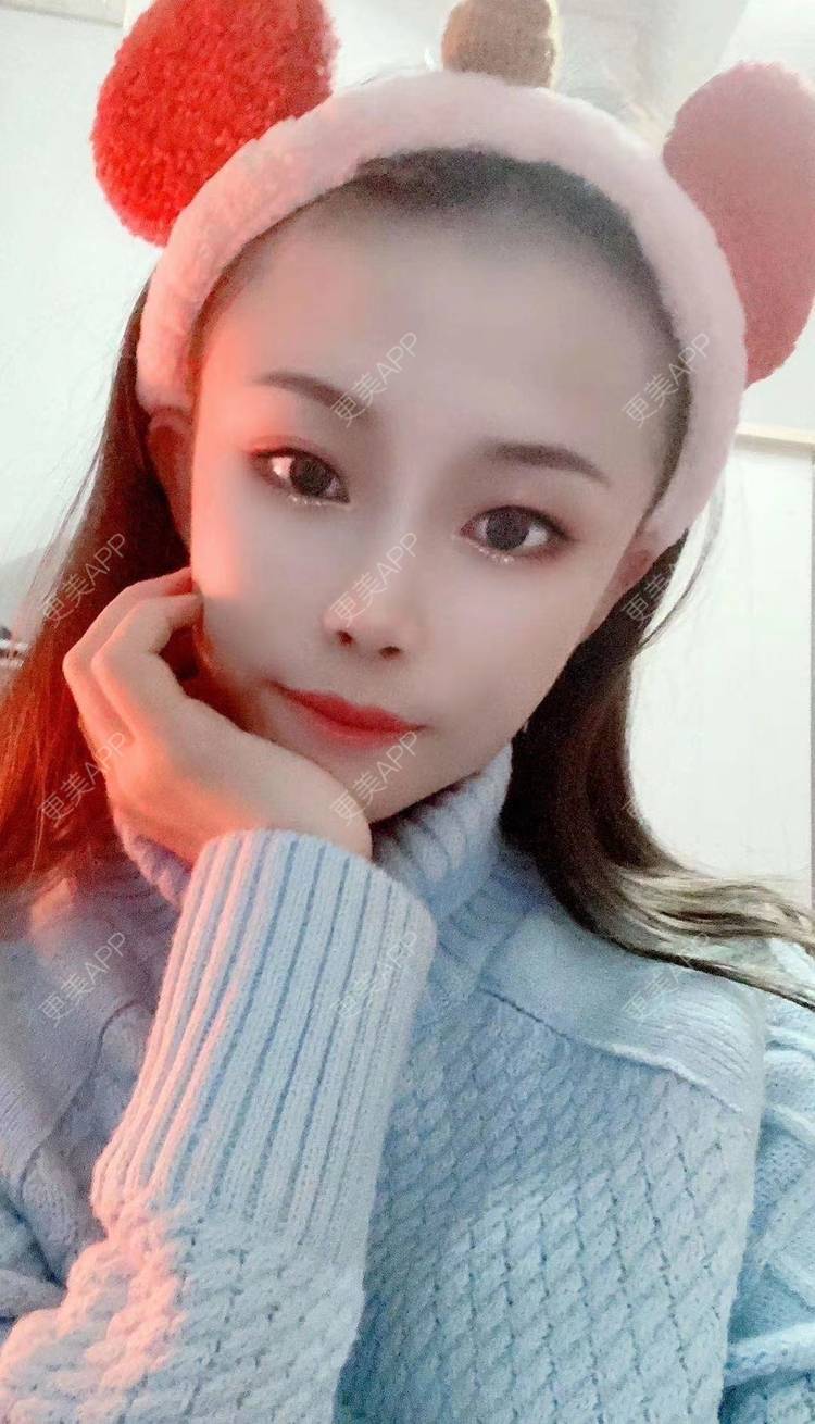 更美 - 更美用户cGlrxNe1rk的热玛吉经验 | 深圳 | 热玛吉