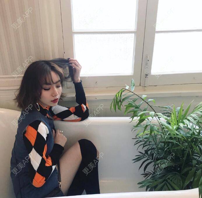 更美 - 更美用户yE8KtSeMLF的鼻形态修复经验 | 鼻形态修复 | 长沙