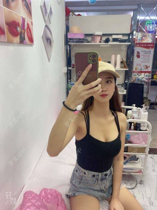 更美 - 更美用户w2D7s0m18c的激光除腋臭经验 | 激光除腋臭 | 深圳