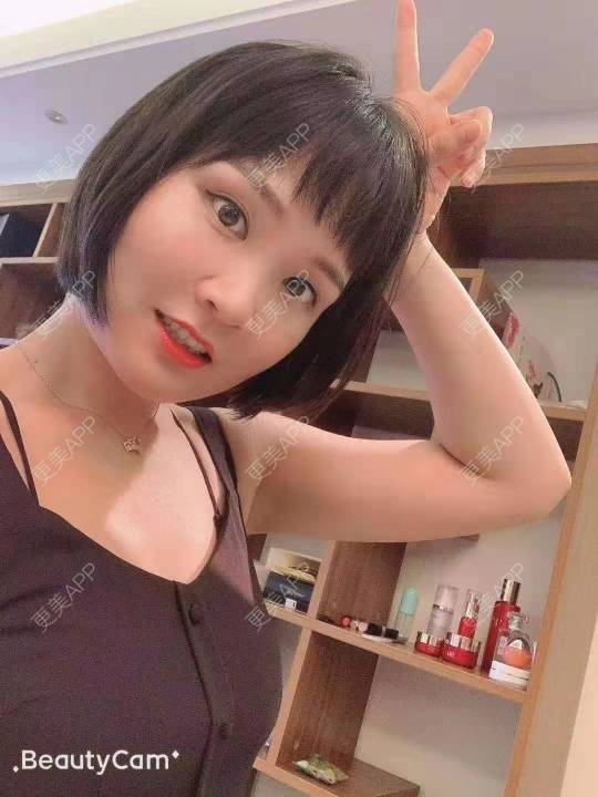 更美 - 更美用户w2D7s0m18c的激光除腋臭经验 | 激光除腋臭 | 深圳