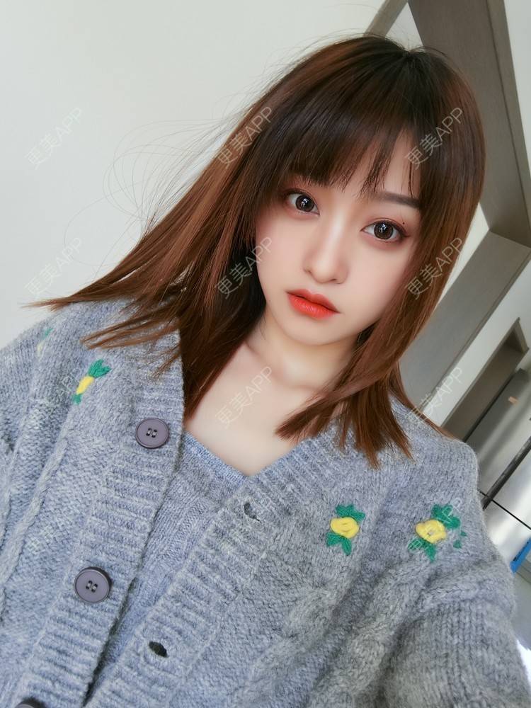 更美 - 本宫就是矫情、哼哼的瘦脸经验 | 注射溶脂瘦脸 | 瘦脸