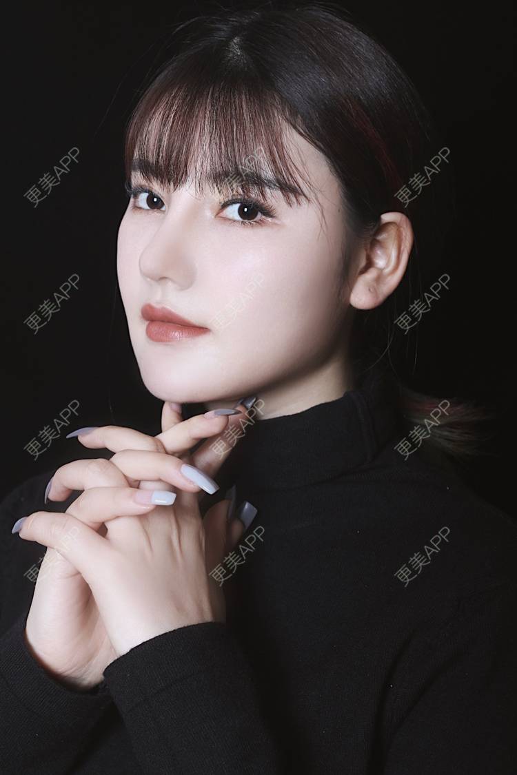 更美 - 湛蓝滴玫瑰的自体软骨垫鼻尖经验 | 自体软骨垫鼻尖 | 鼻翼缩小 | 重庆 | 鼻孔矫正 | 鼻形态修复