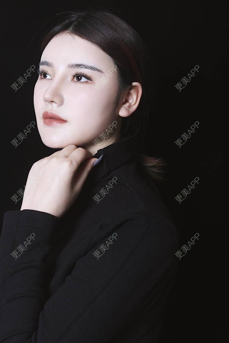 更美 - 湛蓝滴玫瑰的自体软骨垫鼻尖经验 | 自体软骨垫鼻尖 | 鼻翼缩小 | 重庆 | 鼻孔矫正 | 鼻形态修复