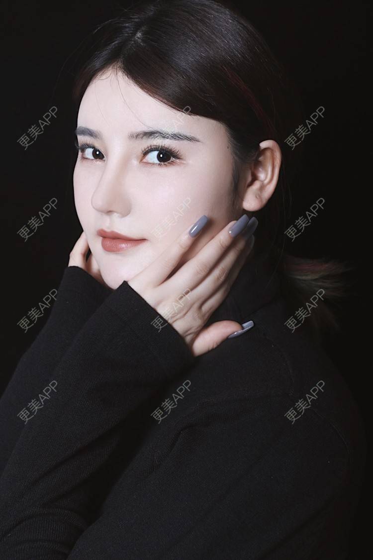 更美 - 湛蓝滴玫瑰的自体软骨垫鼻尖经验 | 自体软骨垫鼻尖 | 鼻翼缩小 | 重庆 | 鼻孔矫正 | 鼻形态修复