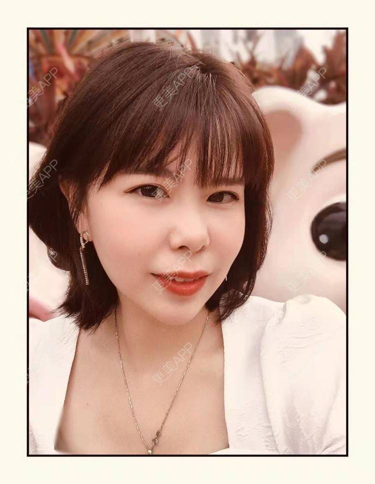 更美 - 更美用户OWCGLJE4j2的下巴经验 | 下巴 | 深圳