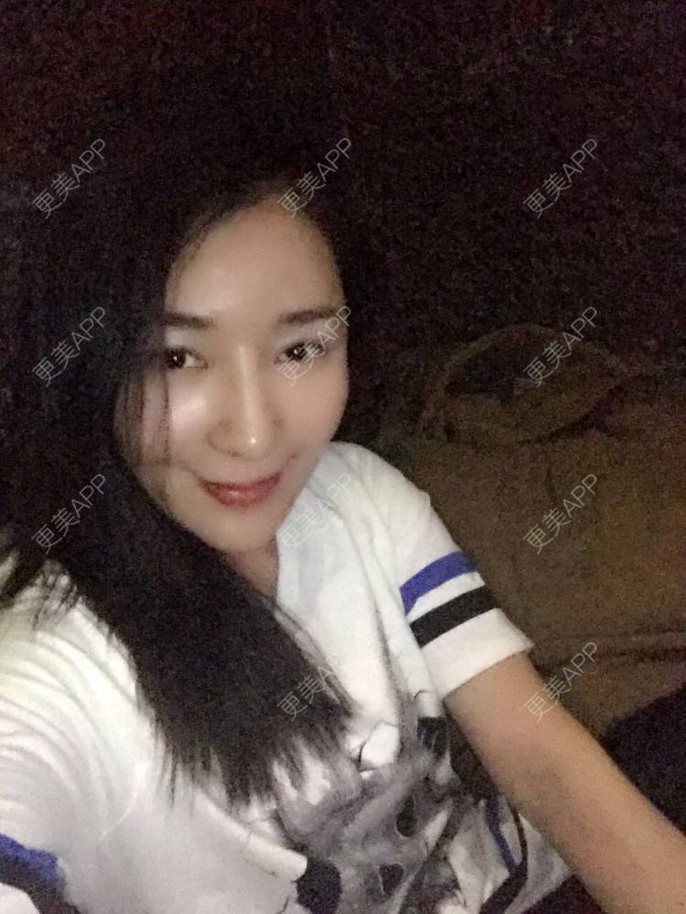更美 - 愤怒的少年的埋线提升经验 | 成都 | 埋线提升