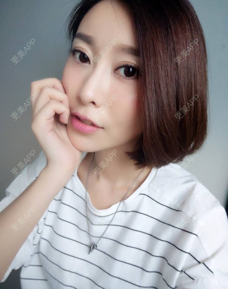 更美 - 我要和床私奔的埋线提升经验 | 成都 | 埋线提升