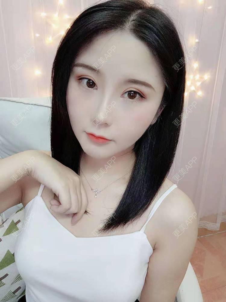 更美 - 尼美们一起的鼻部多项经验 | 鼻部多项 | 膨体隆鼻 | 硅胶隆鼻 | 肋软骨隆鼻 | 耳软骨隆鼻