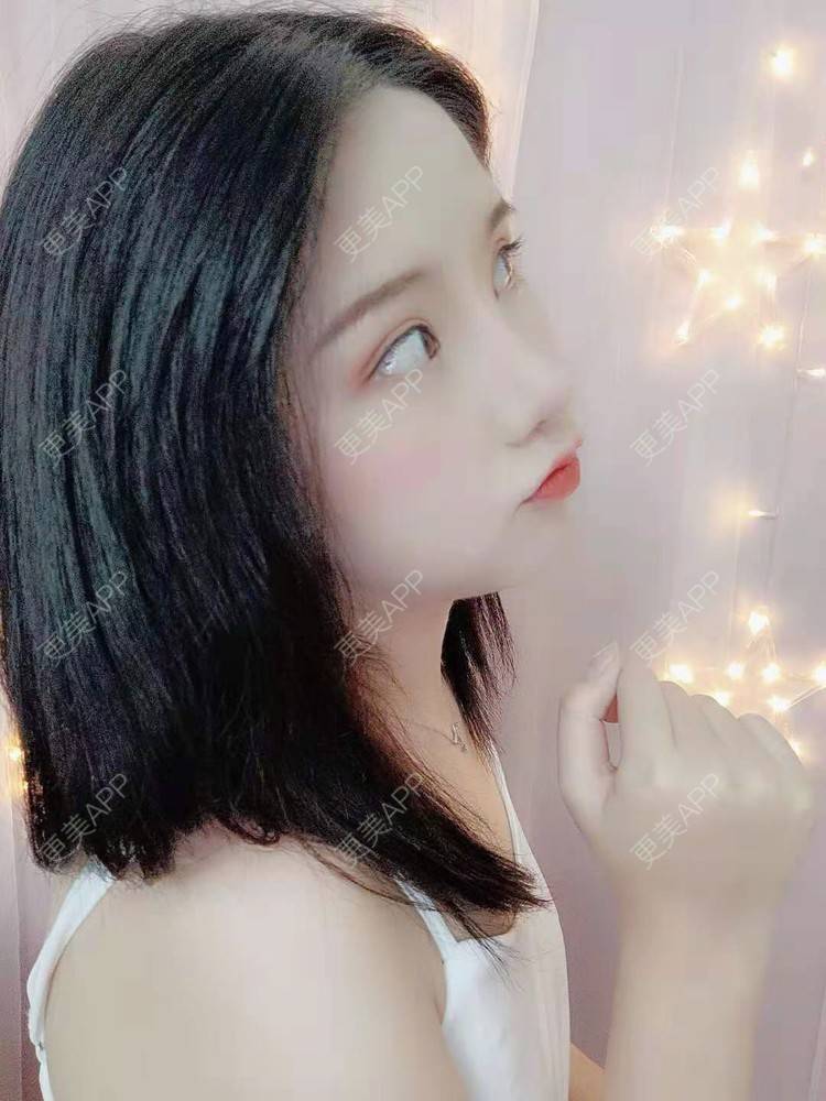 更美 - 尼美们一起的鼻部多项经验 | 鼻部多项 | 膨体隆鼻 | 硅胶隆鼻 | 肋软骨隆鼻 | 耳软骨隆鼻