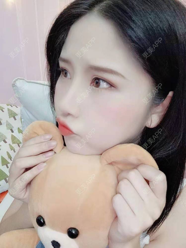 更美 - 尼美们一起的鼻部多项经验 | 鼻部多项 | 膨体隆鼻 | 硅胶隆鼻 | 肋软骨隆鼻 | 耳软骨隆鼻