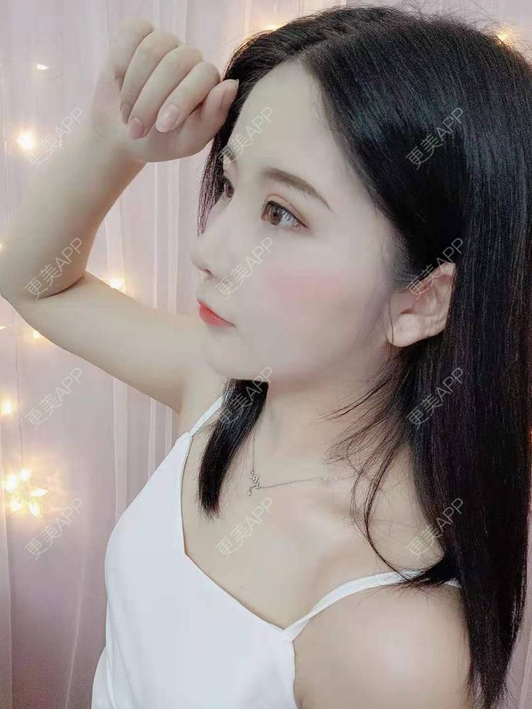 更美 - 尼美们一起的鼻部多项经验 | 鼻部多项 | 膨体隆鼻 | 硅胶隆鼻 | 肋软骨隆鼻 | 耳软骨隆鼻