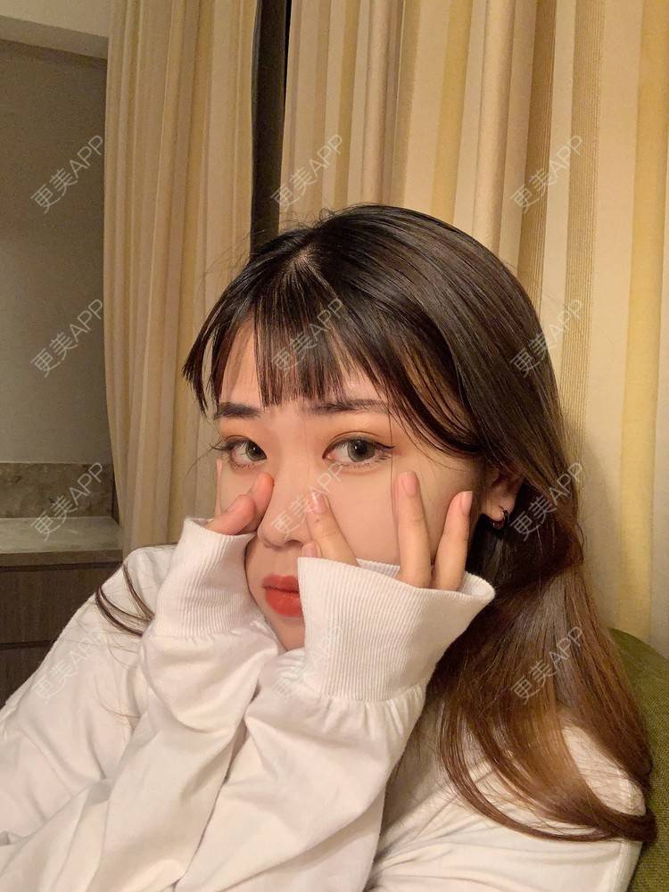 更美 - 淑女注意你的仪态的自体脂肪全面部填充经验 | 杭州 | 自体脂肪全面部填充