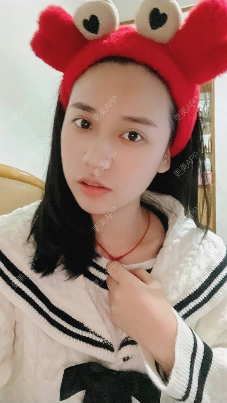 更美 - 紫绿葡萄的眼部修复经验 | 眼部修复 | 重庆