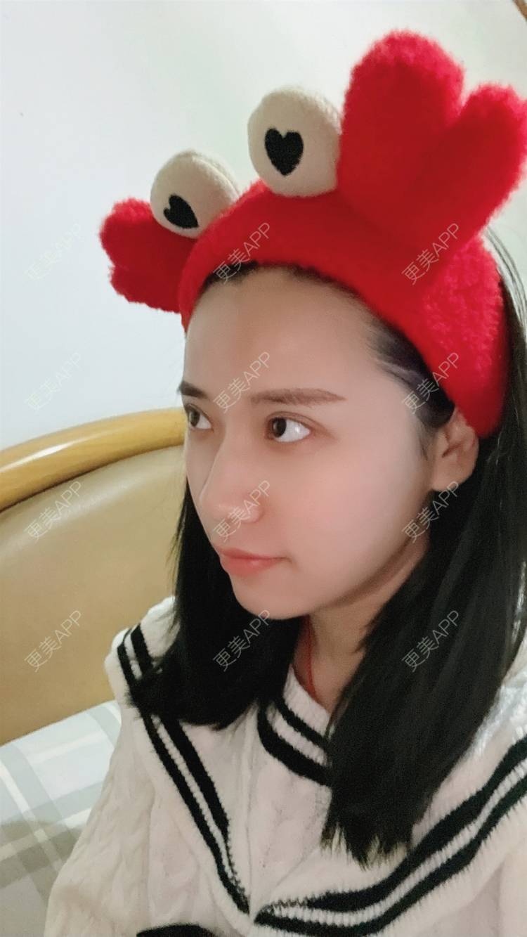 更美 - 紫绿葡萄的眼部修复经验 | 眼部修复 | 重庆