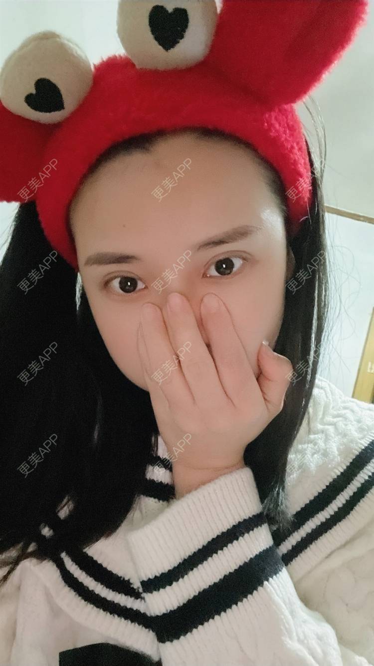 更美 - 紫绿葡萄的眼部修复经验 | 眼部修复 | 重庆