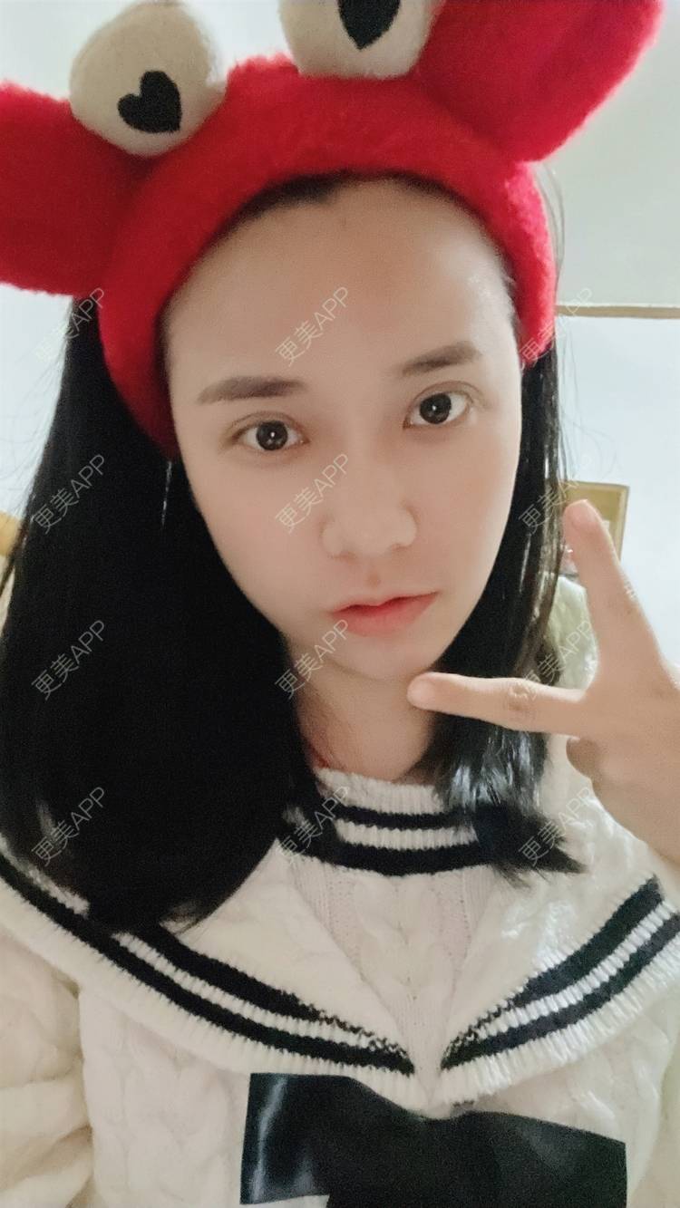 更美 - 紫绿葡萄的眼部修复经验 | 眼部修复 | 重庆