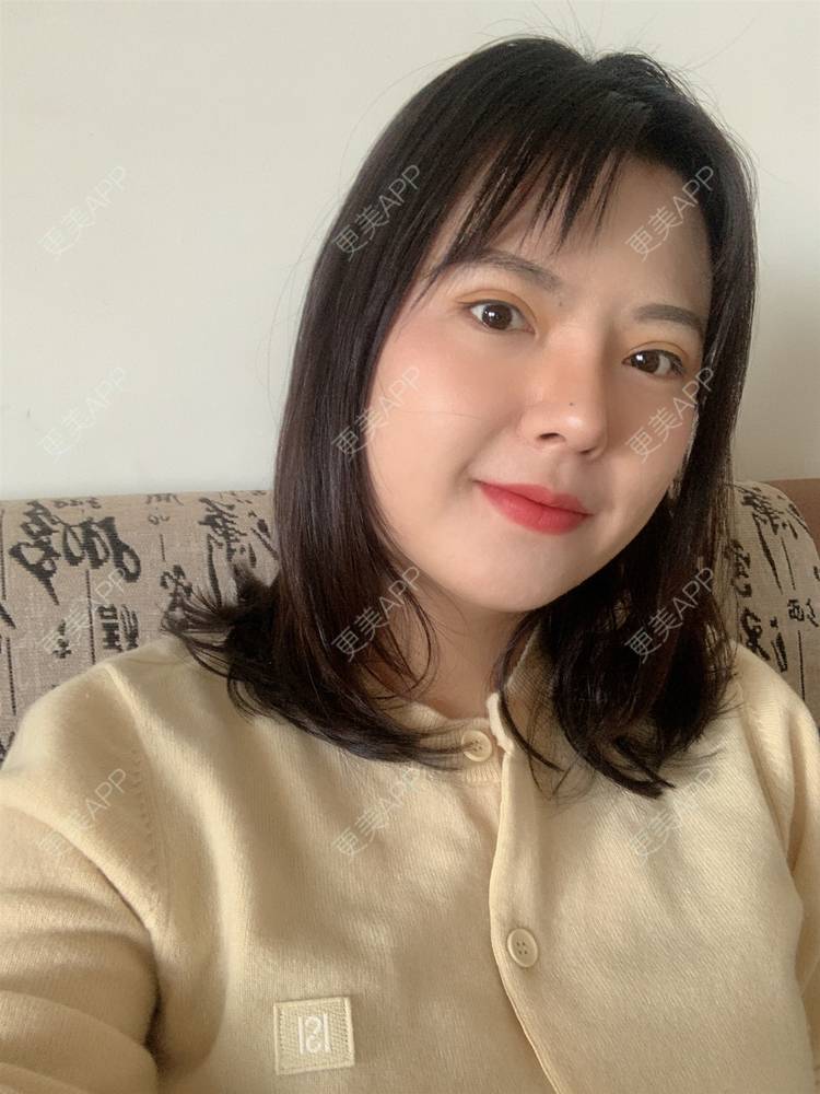 更美 - 落花和忆梦的肋软骨隆鼻经验 | 肋软骨隆鼻 | 重庆 | 鼻形态修复