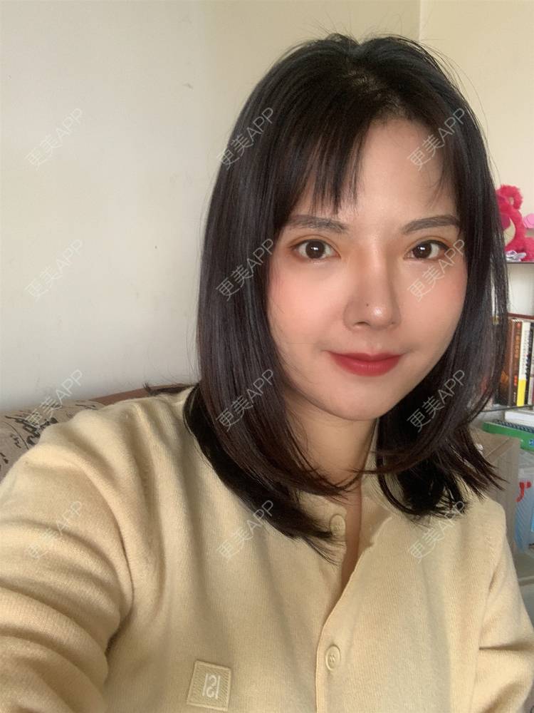 更美 - 落花和忆梦的双眼皮修复经验 | 重庆 | 双眼皮修复