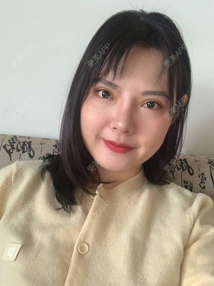 更美 - 落花和忆梦的双眼皮修复经验 | 重庆 | 双眼皮修复